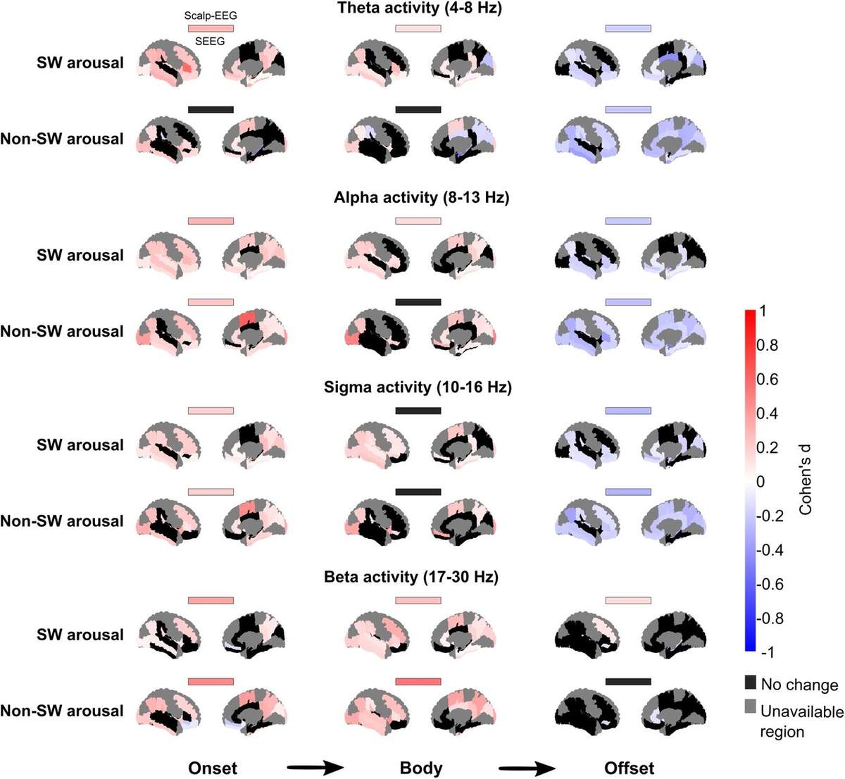 Intracerebral Dynamics Of Sleep Arousals A Combined Scalp Intracranial EEG Study Journal Of Neuroscience Intracerebral Dynamics Of Sleep Arousals A Combined Scalp Intracranial EEG Study Journal Of Neuroscience